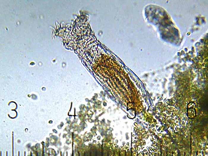An example of a bdelloid rotifer. (Photo by Bob Blaylock.)