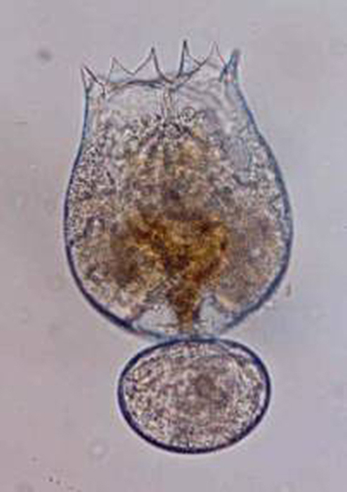 Bodies of brachionid rotifers (such as Brachionus rotundiformis, shown here)  are made up of approximately 1,000 cells. (Photo by Jung Min-Min.) 