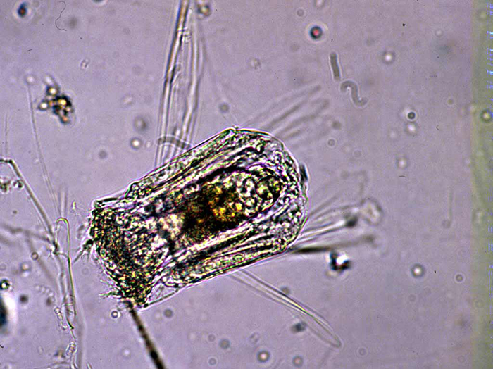 Polyarthra spp. rotifers are often used as test subjects in ecology studies by the EPA. Photo by EPA.