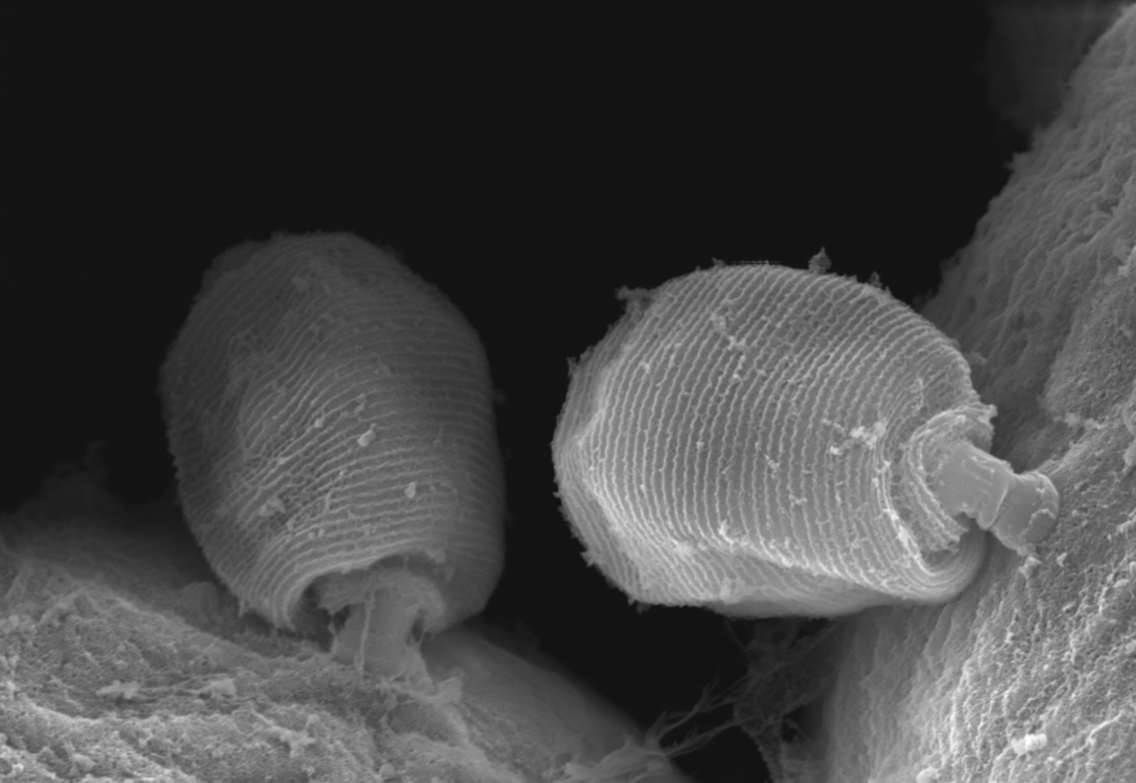 An unexpected discovery: The tag-along friendship of protozoans and polychaetes