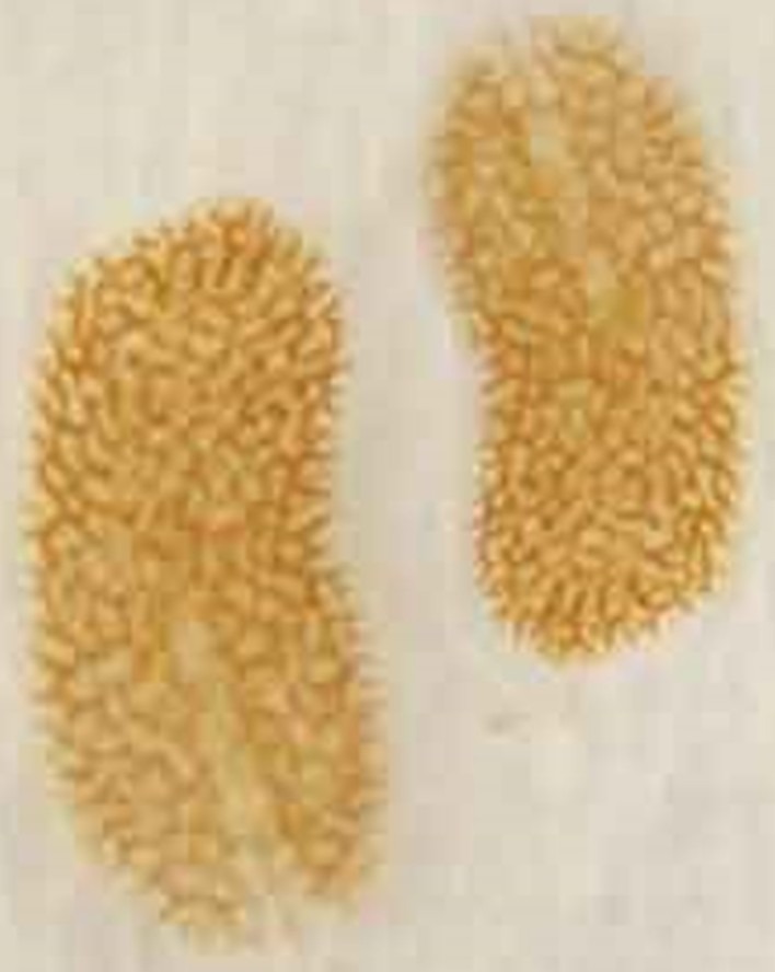 flatworm-acropora-saltwater-aquarium