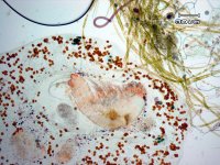 copepod-ameboid.jpg
